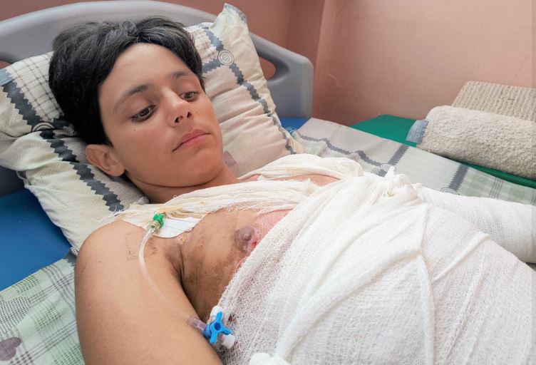 14-річний підліток отримав удар струмом від потяга: жахливі наслідки зачепінгу