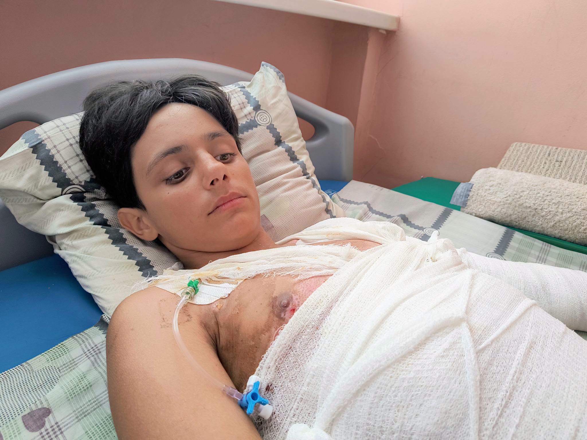 В Одесі підліток отримав 45% опіків, катаючись на даху електрички