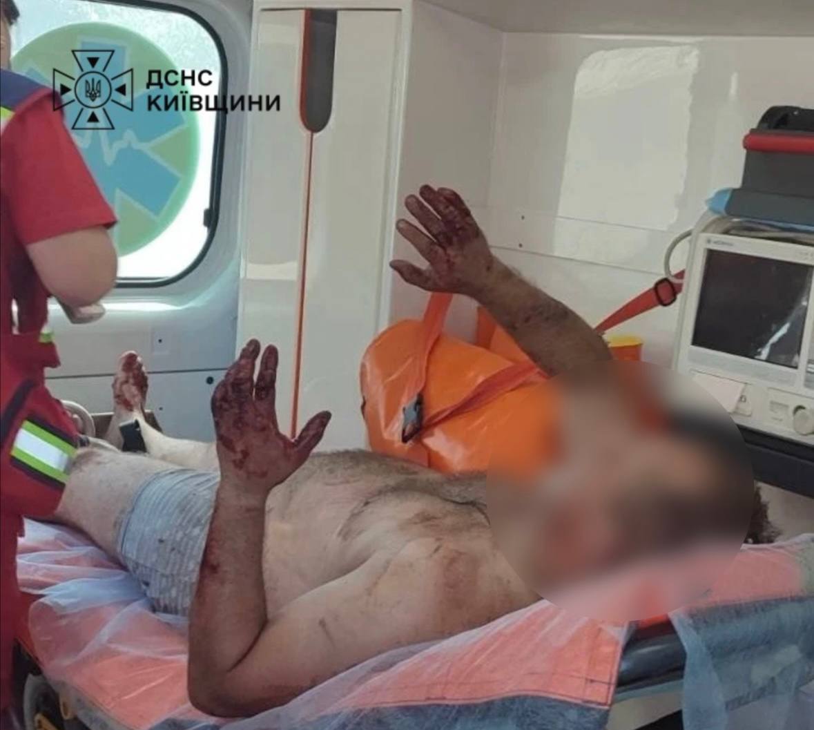 Смертельна пожежа на Київщині: у Ситняках загинула людина