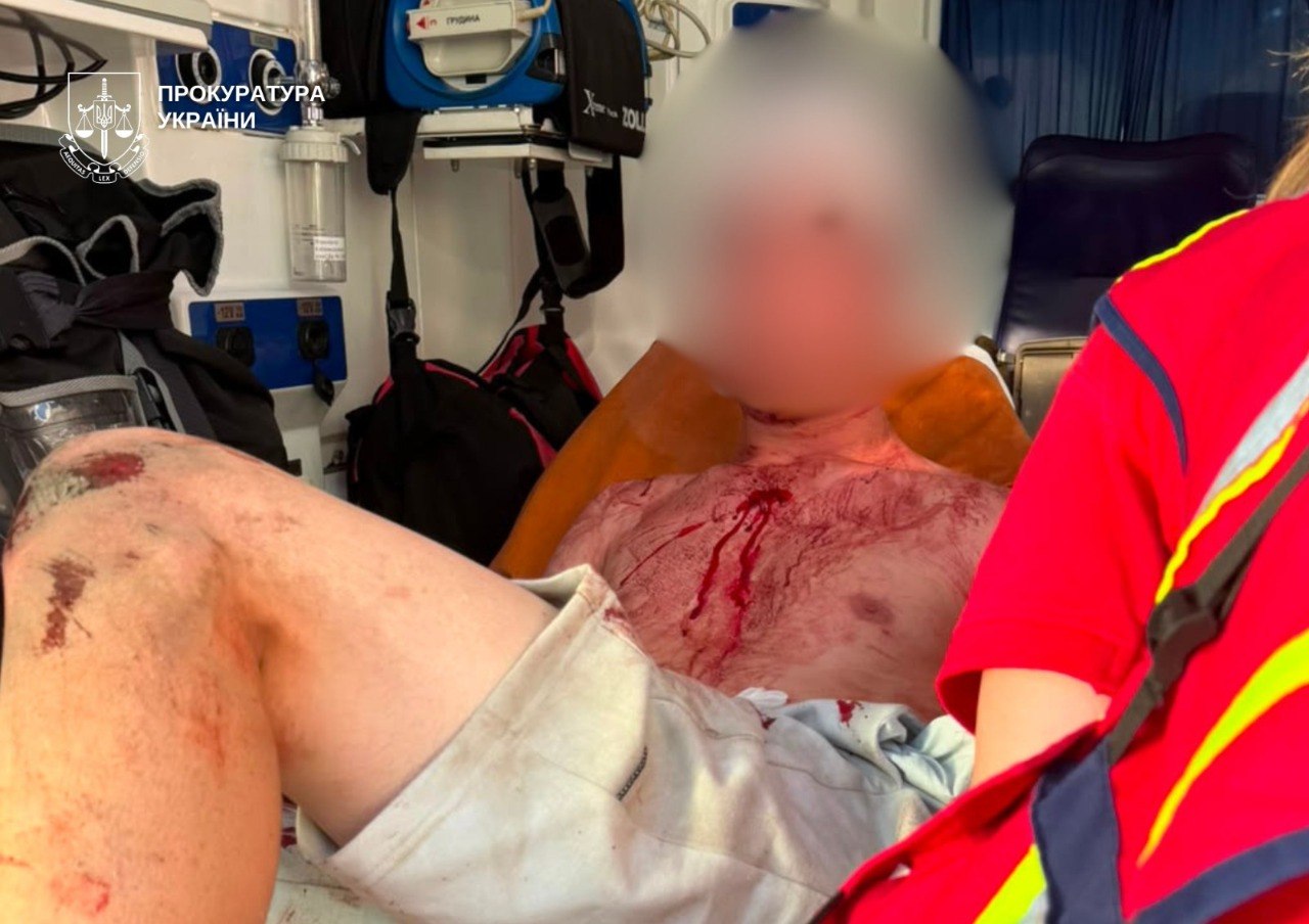 У Києві 19-річного студента підозрюють у замаху на вбивство трьох чоловіків