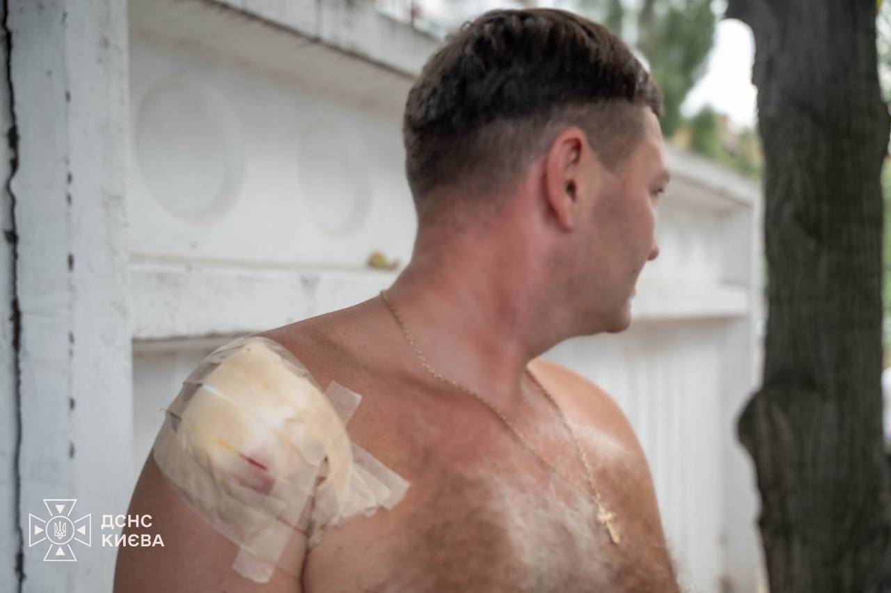 Київ під обстрілами: уламки пошкодили кафе, житловий комплекс та нежитлову будівлю