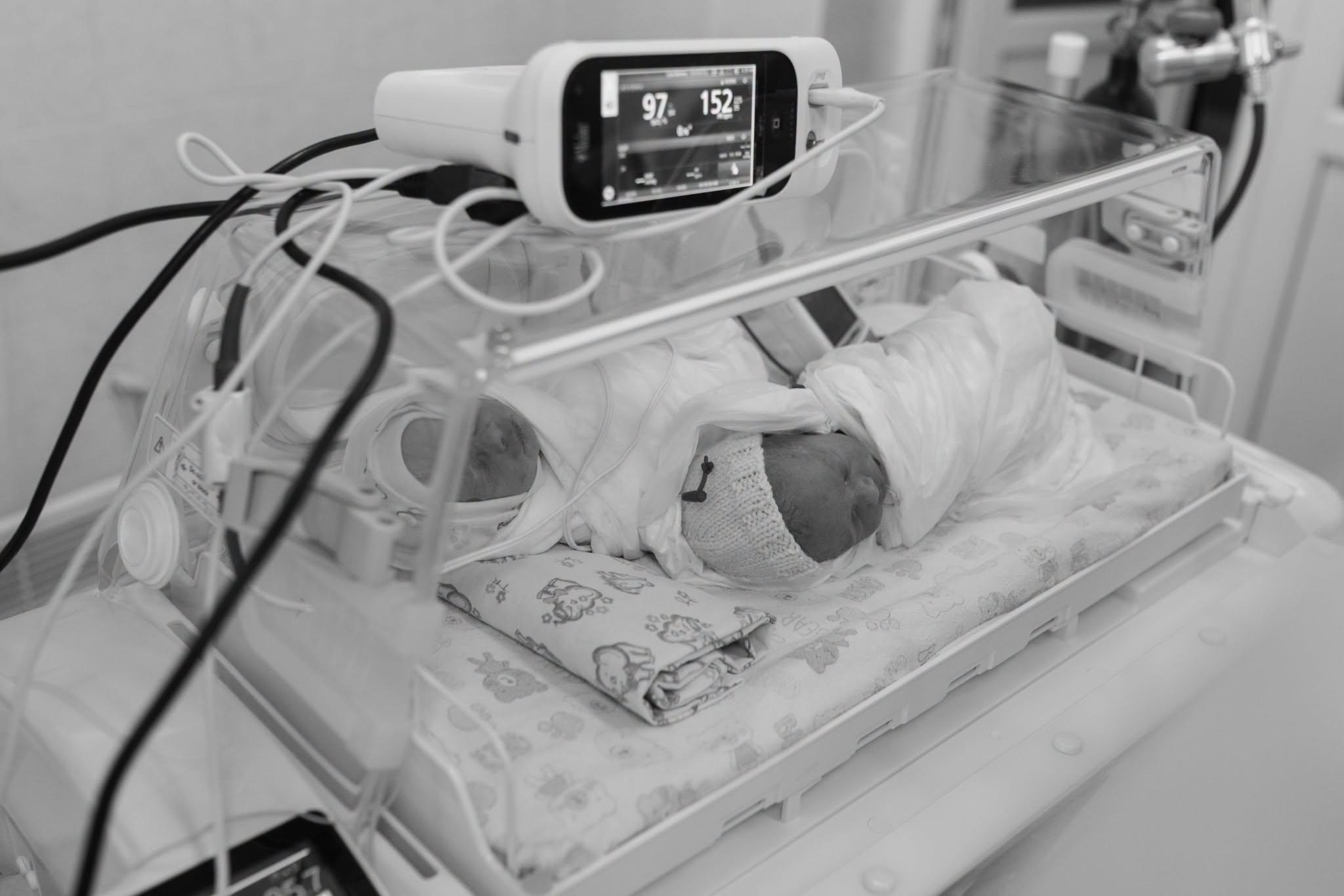 Унікальний бебі-бум у Києві: 9 немовлят за добу, зокрема трійня та двійня